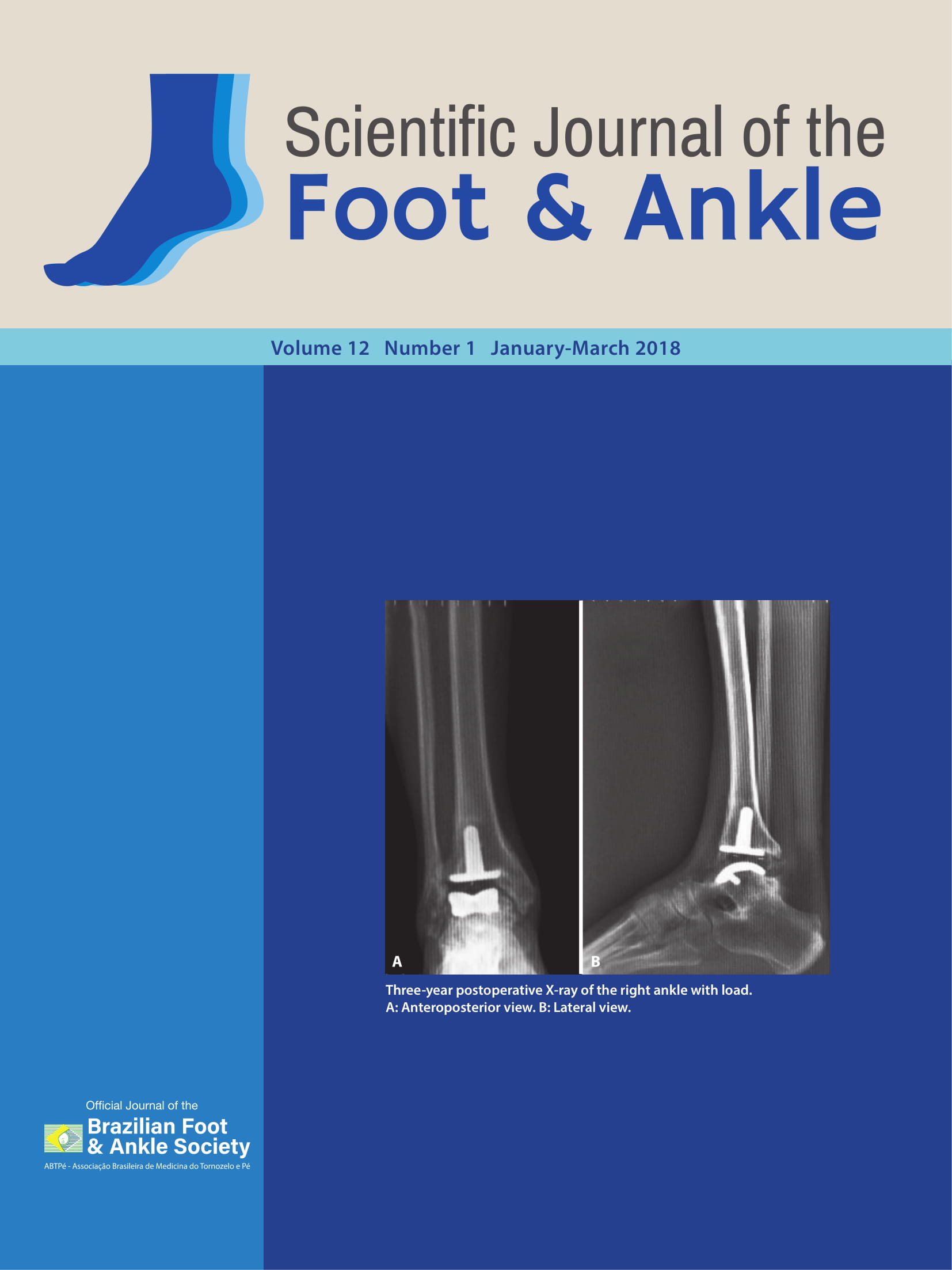 					Visualizar v. 12 n. 1 (2018): Scientific Journal of the Foot and Ankle
				