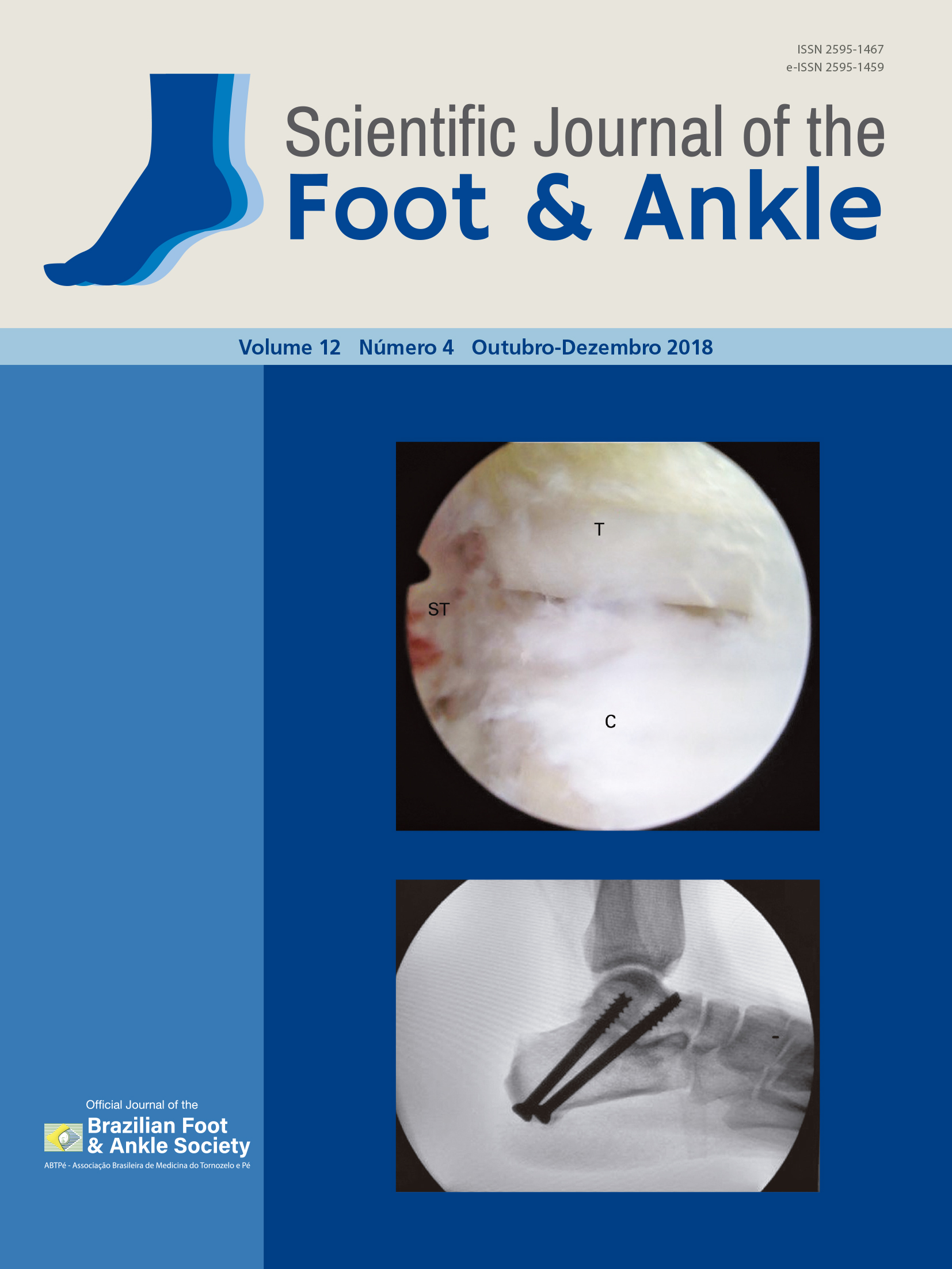 					View Vol. 12 No. 4 (2018): Scientific Journal of the Foot and Ankle
				