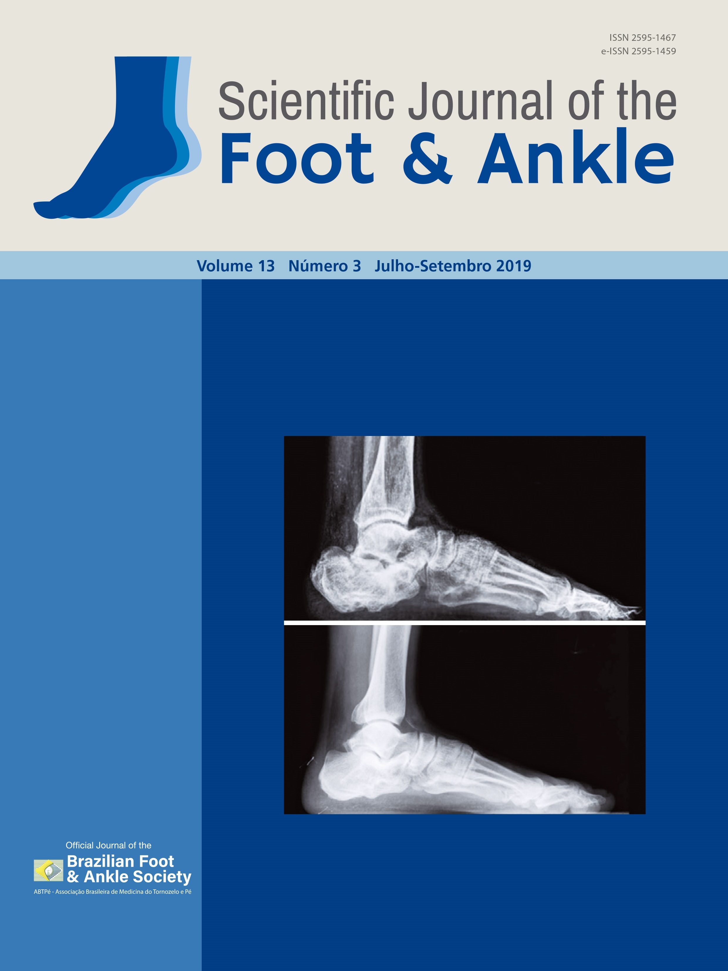 					Visualizar v. 13 n. 3 (2019): Scientific Journal of the Foot and Ankle
				