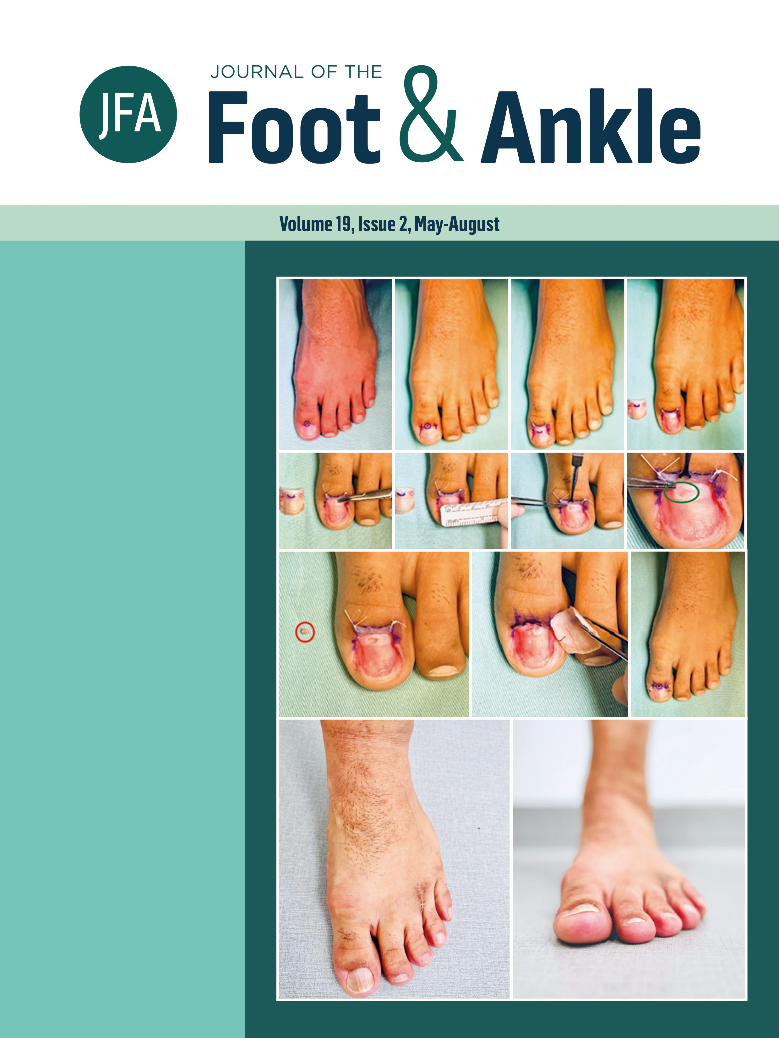 					View Vol. 19 No. 2 (2025):  Journal of the Foot and Ankle
				
