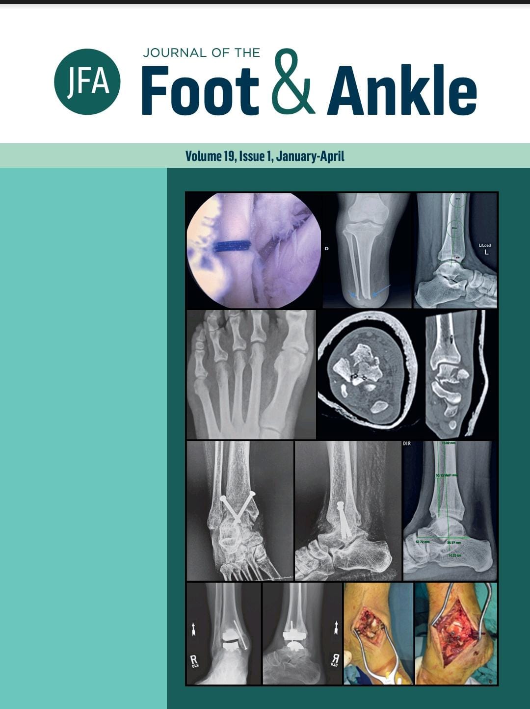 					View Vol. 20 No. 1 (2026): Journal of the Foot Ankle
				