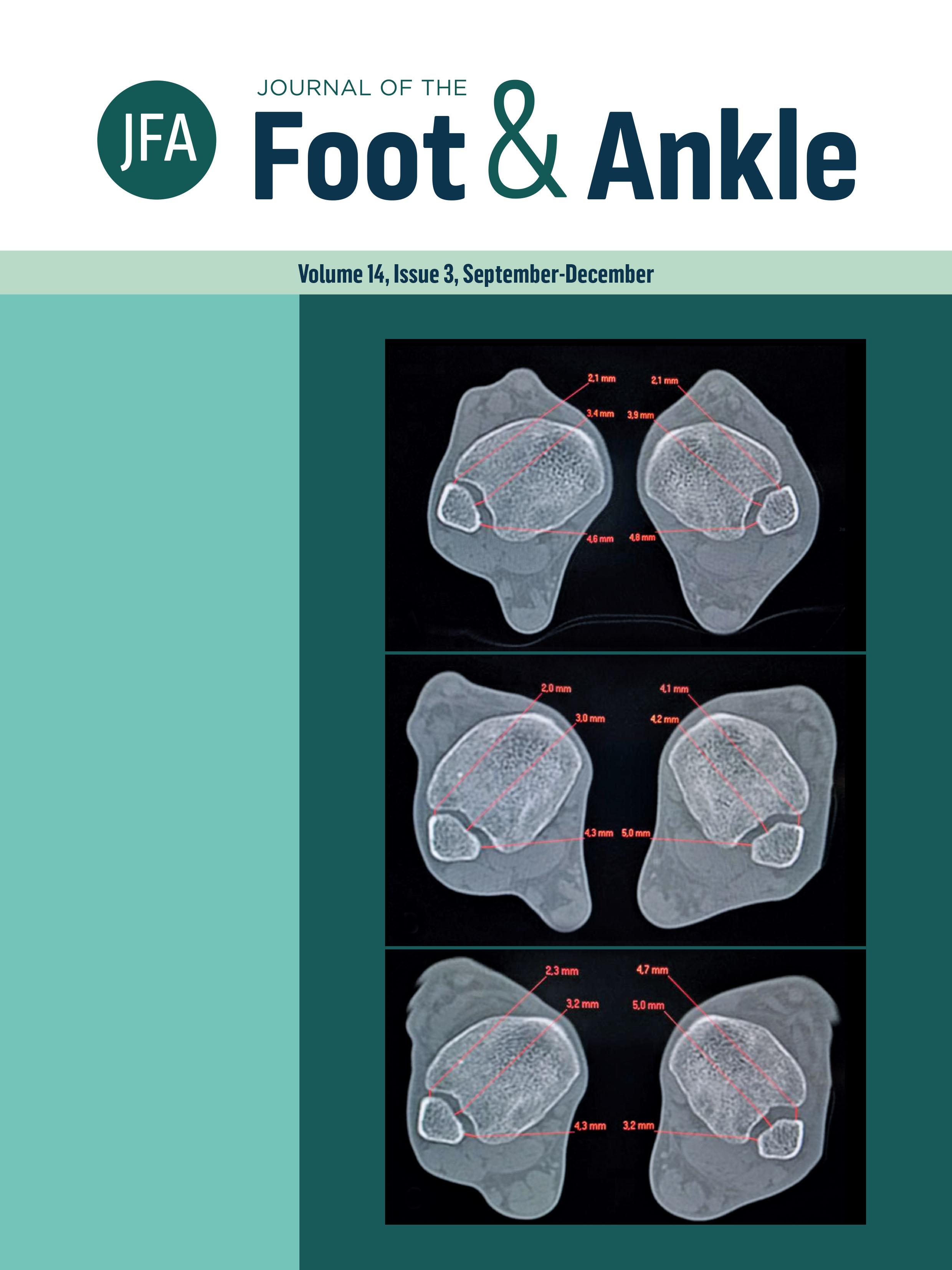					View Vol. 14 No. 3 (2020): Journal of the Foot and Ankle
				